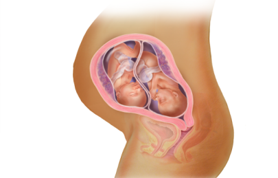 Kinh nghiệm chăm sóc bà bầu song thai