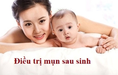 Thực hư mụn sau sinh có tự hết hay không ?