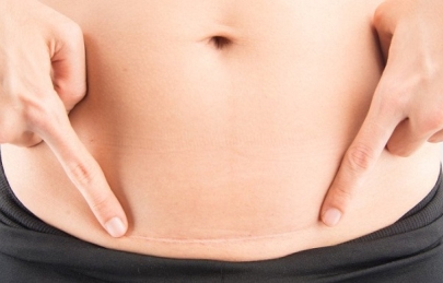 5 nguyên tắc giảm cân sau sinh mổ 1 tháng mẹ nhất định phải biết!