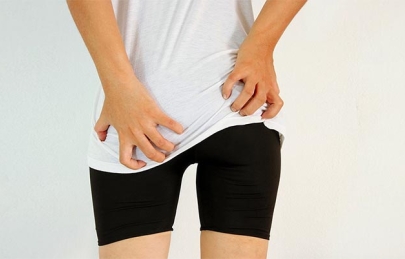 Cách chữa trị thâm ghẻ ở mông được nhiều người tin dùng