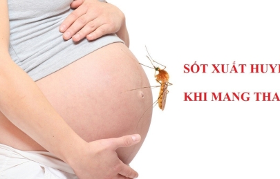 Chăm sóc bà bầu bị sốt xuất huyết biện pháp hạn chế biến chứng nguy hiểm khi mang thai 