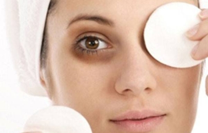 Thâm mấy cũng hết với những bí quyết trị thâm quầng mắt lâu năm