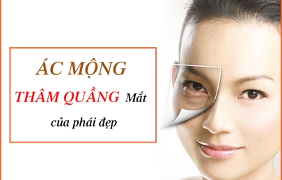 Trị thâm quầng mắt bẩm sinh tại nhà dứt điểm sau 1 tuần