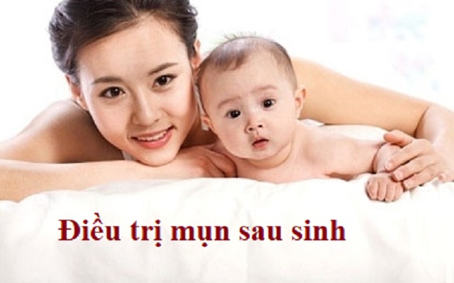 Mụn sau sinh và phương pháp điều trị hiệu quả